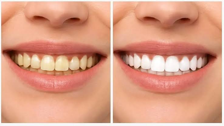 Illustrative smile gallery placeholder 03